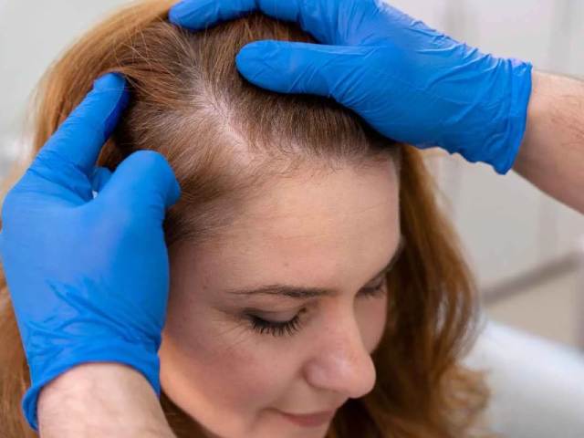 Hair Booster Follicle X